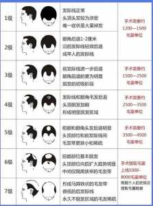 植发多少钱一根啊？植发1根多钱？-第6张图片