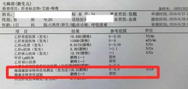 查传染病四项挂什么科多少钱，传染四项检查很丢人吗？-第3张图片